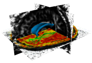Segmentation of Anatomical Structure from DT-MRI