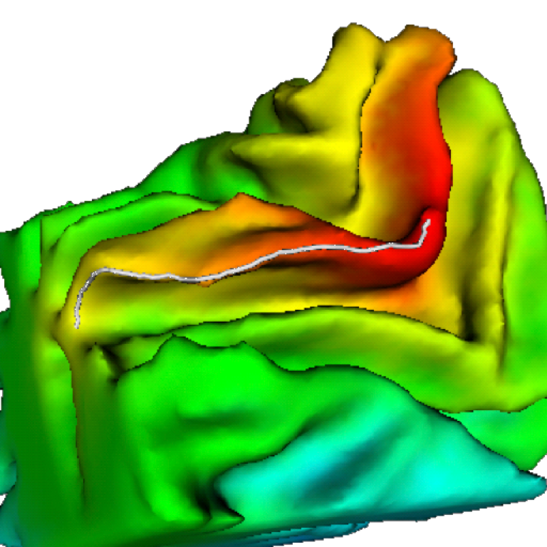 Finding Geodesic Curves on 3D Brain Images